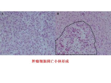 ZT《病理医师问答-3》图6