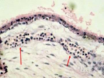 妊娠绒毛：是有核红细胞吗？图6