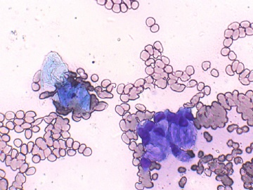 宫颈刮片1图5