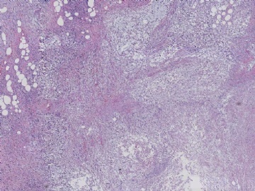 B3-13(美国MD ANDERSON肿瘤中心)图6