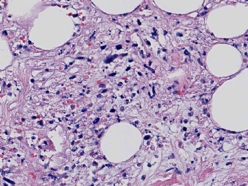 B3-13(美国MD ANDERSON肿瘤中心)图16