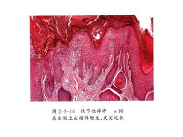 病理医师问答-8（皮肤）图3