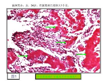 基础病理图片讨论-1（答案公布）图2