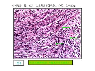 基础病理图片讨论-1（答案公布）图4