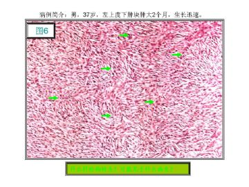 基础病理图片讨论-1（答案公布）图6