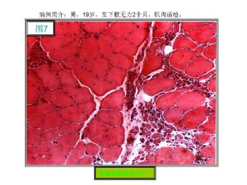 基础病理图片讨论-1（答案公布）图7