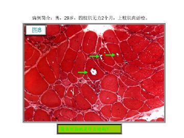 基础病理图片讨论-1（答案公布）图8