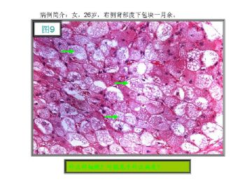 基础病理图片讨论-1（答案公布）图9