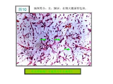 基础病理图片讨论-1（答案公布）图10