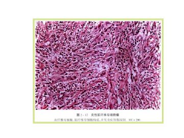 病理医师问答-10（软组织）图11