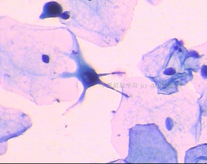 （细胞学新手）请教各位老师，该例女 37岁体检TCT有问题吗？谢谢老师们指教图2