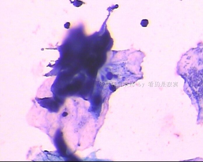 （细胞学新手）请教各位老师，该例女 37岁体检TCT有问题吗？谢谢老师们指教图4