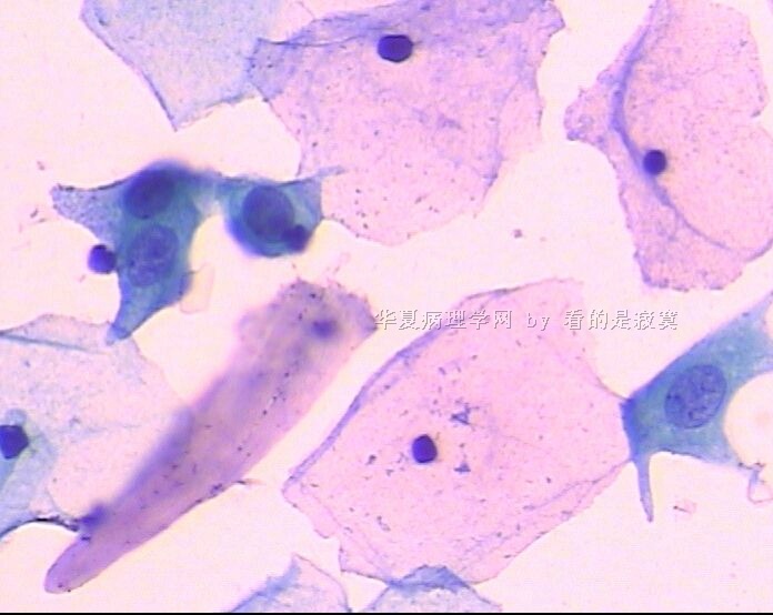 （细胞学新手）请教各位老师，该例女 37岁体检TCT有问题吗？谢谢老师们指教图9