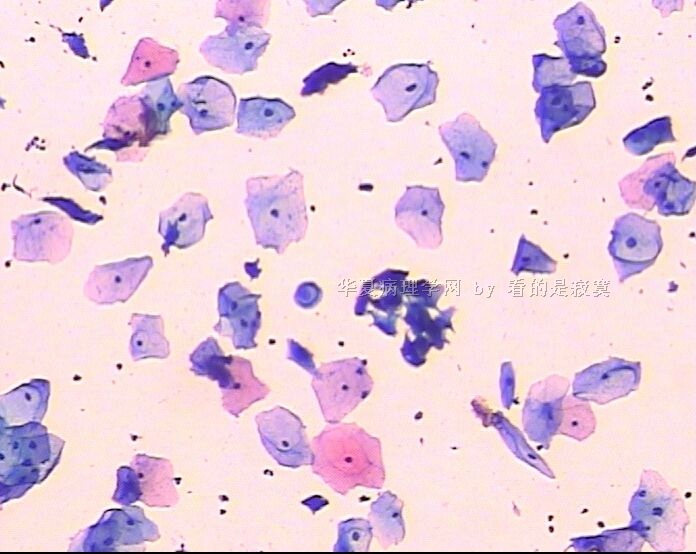 （细胞学新手）请教各位老师，该例女 37岁体检TCT有问题吗？谢谢老师们指教图10