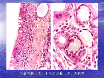 组织胚胎学-呼吸系统（图片）图7