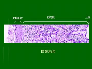 胃粘膜组织学图10