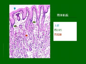 胃粘膜组织学图11