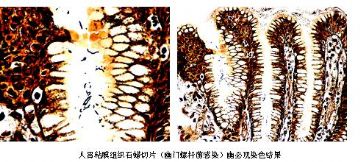 显示幽门螺杆菌的银染法有了改良版本了，呵呵图1