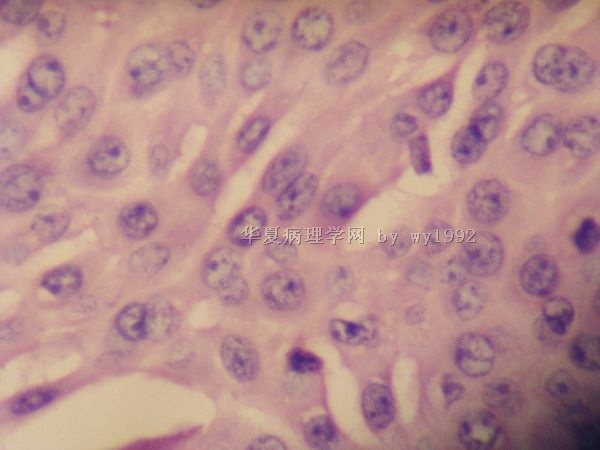 头部赘生物201101160图7