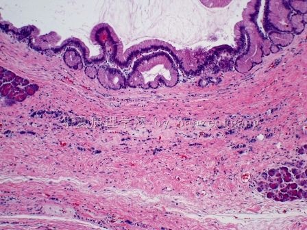 Pancreatic lesion图7