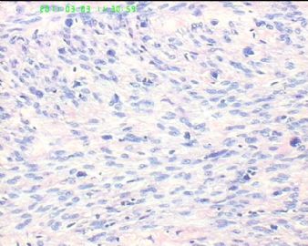 78岁女性子宫肌瘤，片中深染的是什么细胞？图6