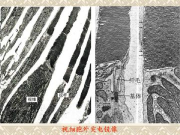 组织胚胎学-眼和耳（图片）图14