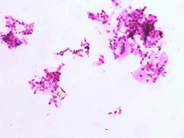 宫颈液基请教图3