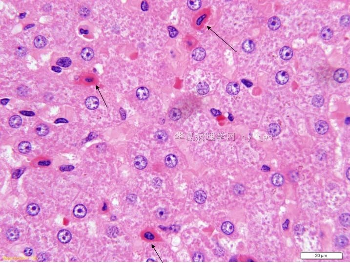 狗肝脏-看看箭头所指什么细胞。图1