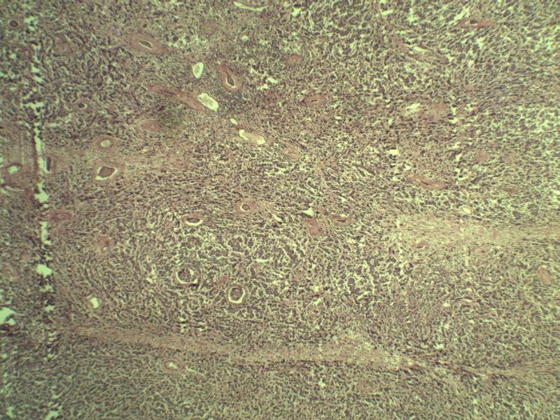 腹腔隐睾图6 腹腔隐睾图6