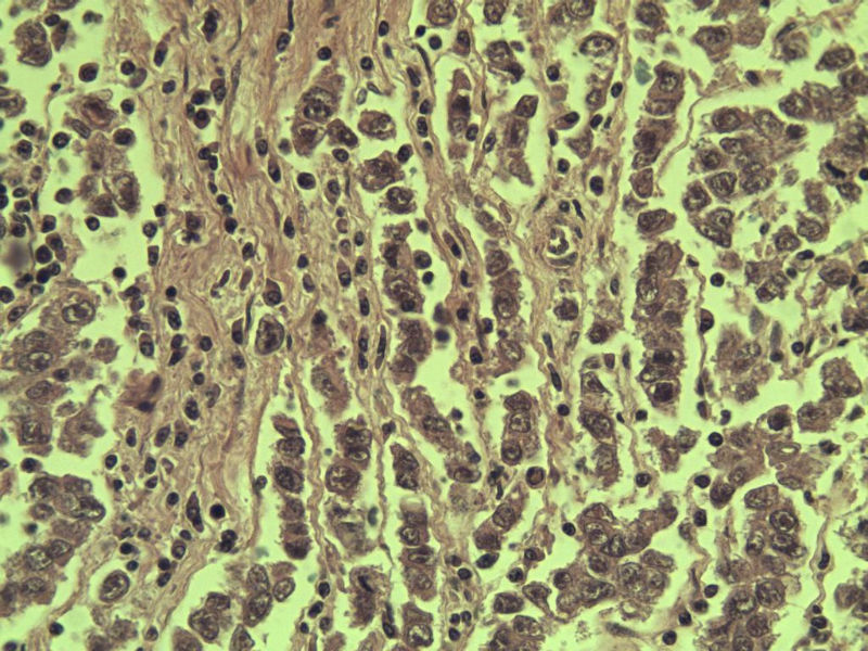 腹腔隐睾图25 腹腔隐睾图25