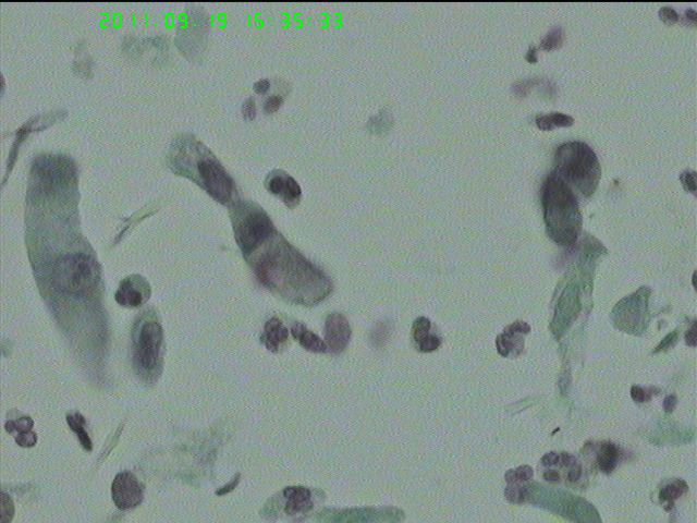LCT再来一例图10