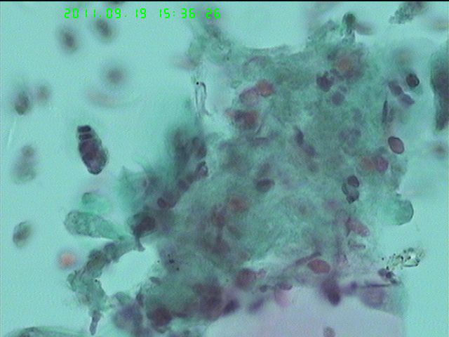 LCT再来一例图12