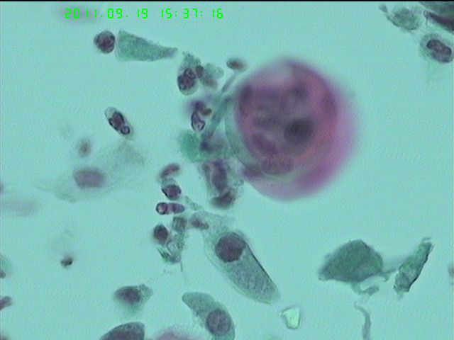 LCT再来一例图15