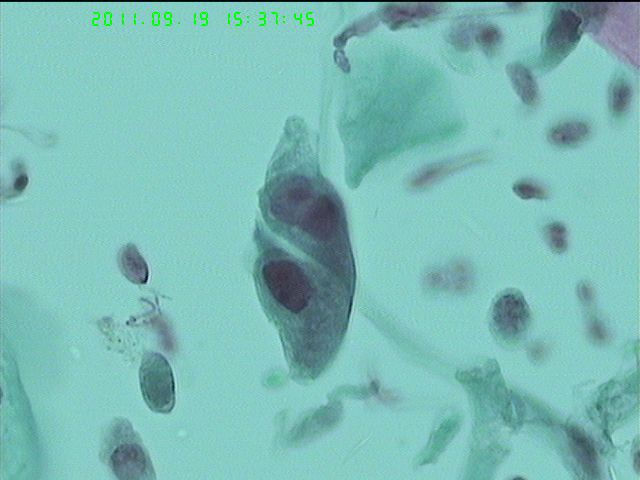 LCT再来一例图17