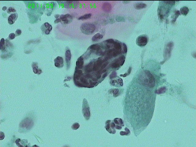 LCT再来一例图18