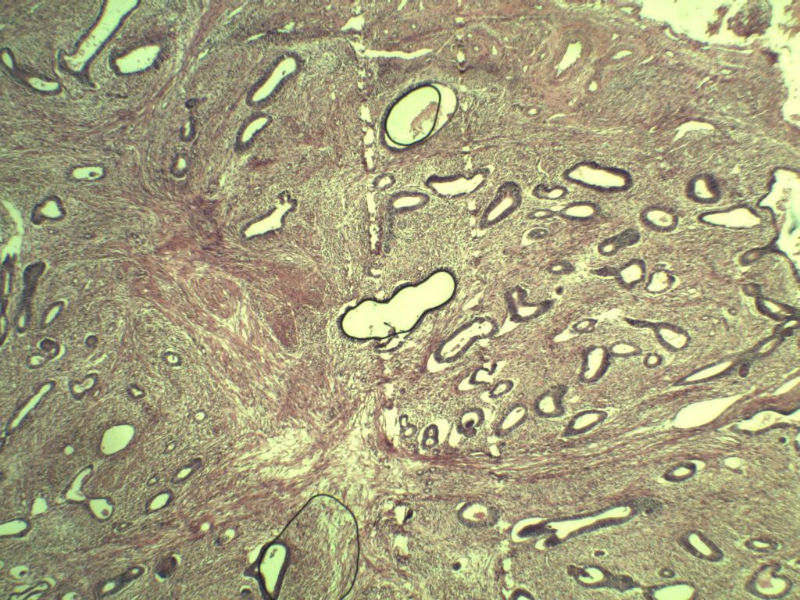 子宫颈管上段图5