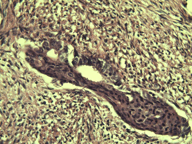 子宫颈管上段图18