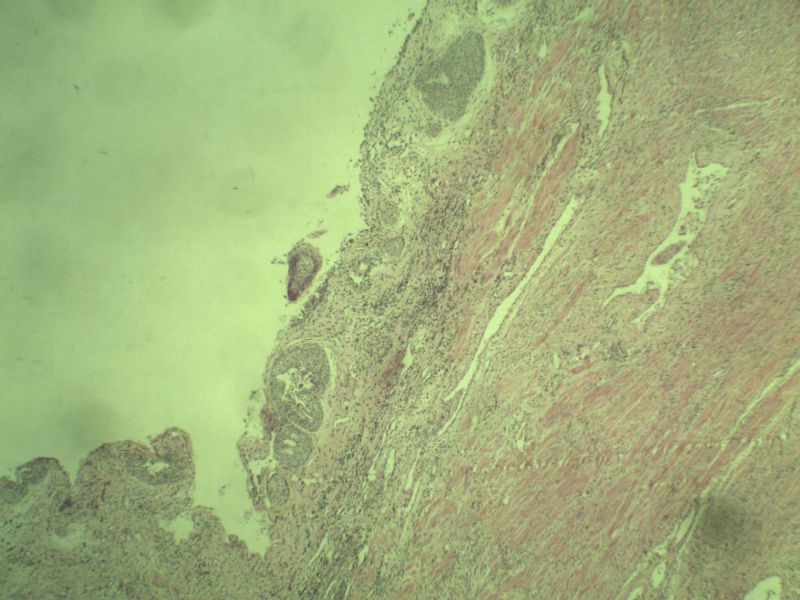 前列腺有问题没?图2