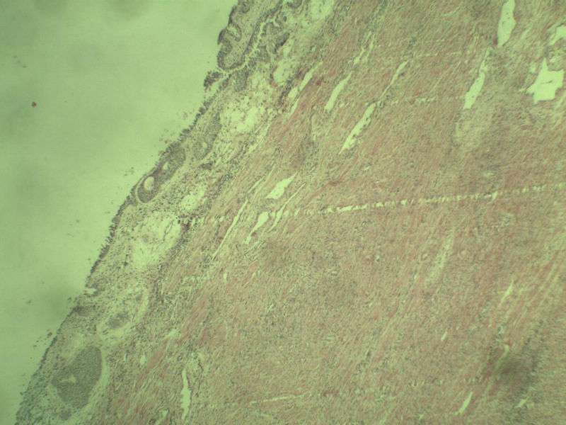 前列腺有问题没?图3
