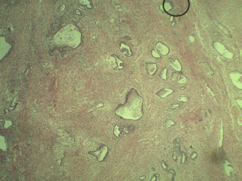 前列腺有问题没?图4