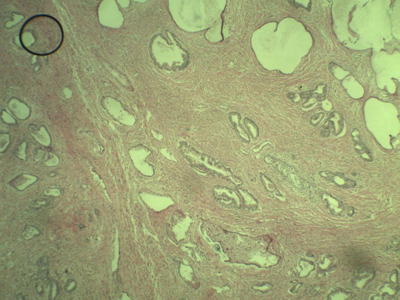 前列腺有问题没?图5