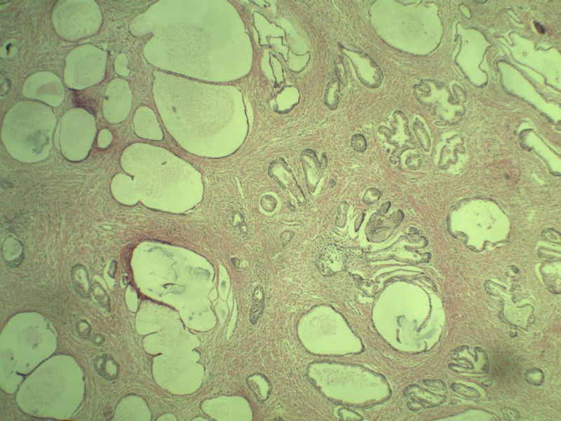前列腺有问题没?图6