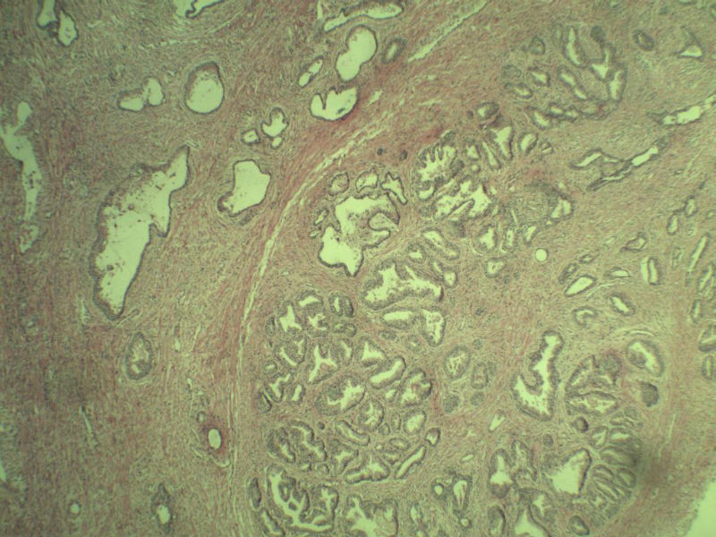 前列腺有问题没?图7