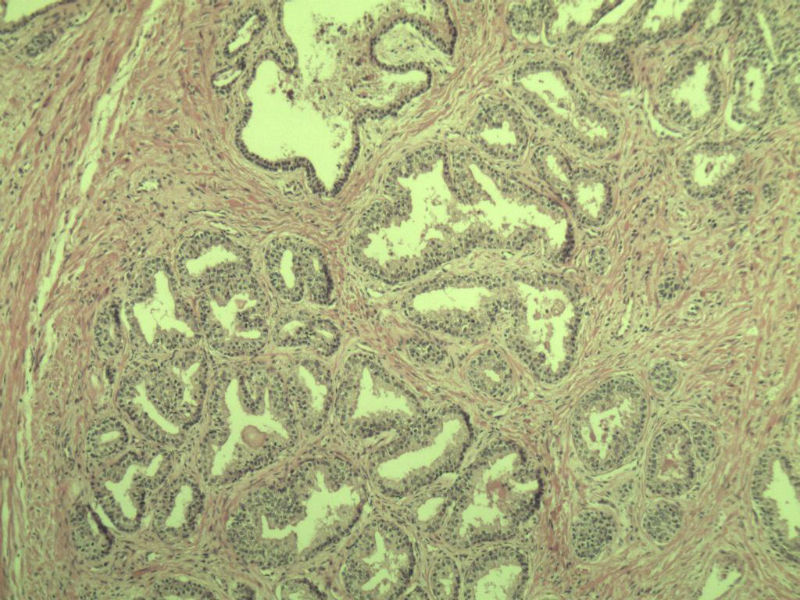 前列腺有问题没?图8