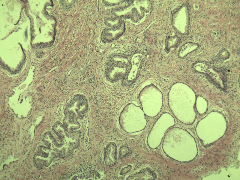 前列腺有问题没?图9
