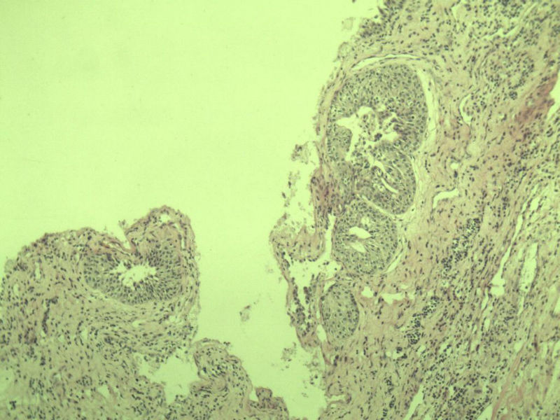 前列腺有问题没?图12