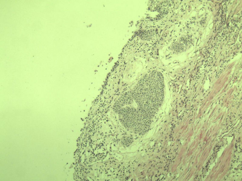 前列腺有问题没?图13