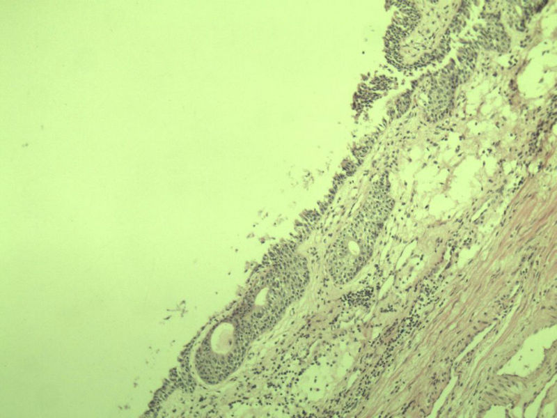 前列腺有问题没?图14