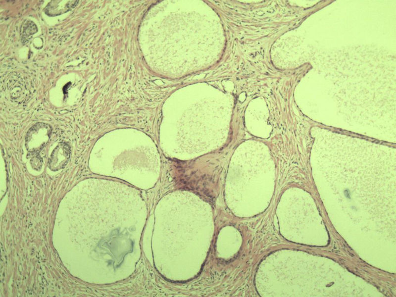 前列腺有问题没?图16