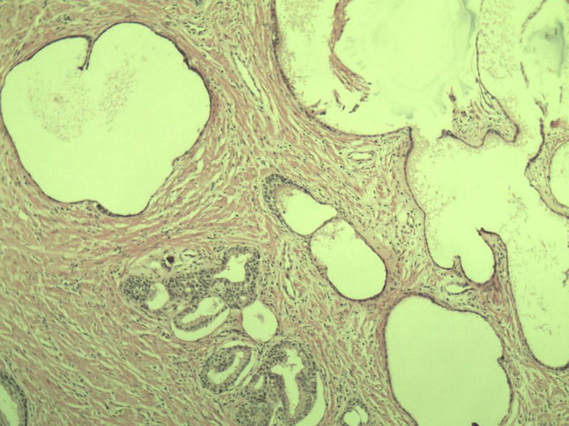 前列腺有问题没?图17